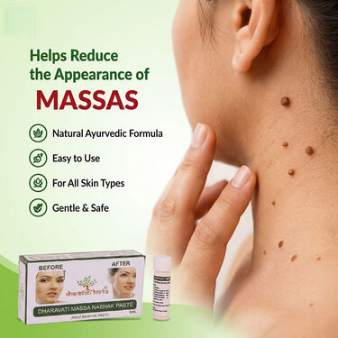 Ayurvedic Massa Removal Cream