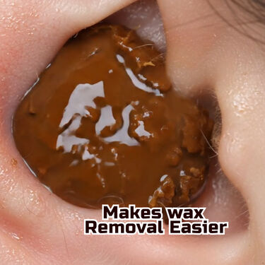 Gentle & Safe Ear Wax Remover Spray (BC18)