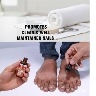 Toenail Care & Comfort Drops (FTCR7)