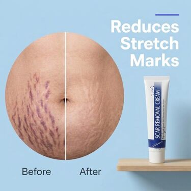 Cuts & Scars Removal Cream B1G1 (BC33)
