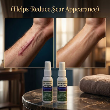 Body Scar Correcting Spray B1G1 (BC35)